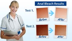 anal bleach